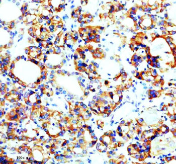 IHC analysis of SEC63 using anti-SEC63 antibody. SEC63 was detected in a paraffin-embedded section o