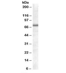 Western blot testing of human heart lysate with COL4A3BP antibody at 1ug/ml. Predicted molecular wei