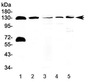 Western blot testing of 1) human 22RV1, 2) human Jurkat, 3) rat pancreas, 4) mouse pancreas and 5) m