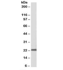 Western blot testing of mouse liver lysate with Ascl3 antibody at 0.1ug/ml. Predicted molecular weig