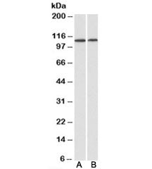 Western blot testing of human heart [A] and kidney [B] lysates with BMP antibody at 1ug/ml. Predicte