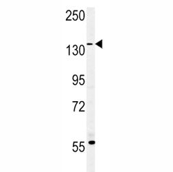 MUC1 antibody western blot analysis in MDA-MB435 lysate. Predicted molecular weight: 120-500 kDa dep