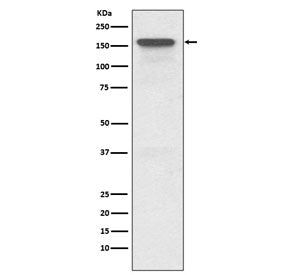 Western blot testing of human HeLa cell lysate with MDR1 antibody. Expected molecular weight: 141-18