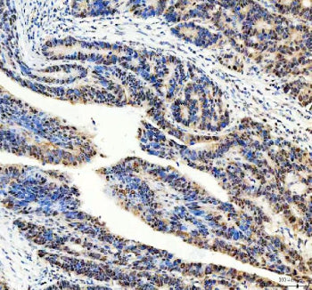 Immunohistochemical staining of DNMT3A using anti-DNMT3A antibody. DNMT3A was detected in a paraffin