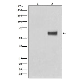Western blot testing of human MCF7 cells 1) untreated and 2) treated with b-Estradiol and EGF, with 
