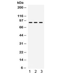 Western blot testing of human 1) HeLa, 2) HUT and 3) SW620 cell lysate with TAP1 antibody. Expected/