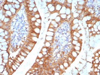 FABP2 Antibody