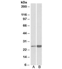 Western blot testing of human heart [A] and liver [B] lysates with Peroxiredoxin 6 antibody at 0.3ug