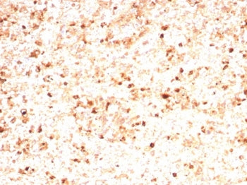 MPO Antibody / Myeloperoxidase