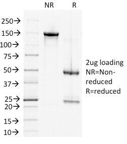 SDS-PAGE Analysis of Purified, BSA-Free DSG2 Antibody (clone 6D8). Confirmation of Integrity and Pur