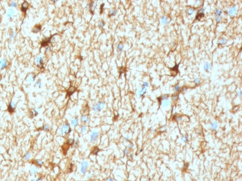GFAP Antibody / Glial Fibrillary Acidic Protein