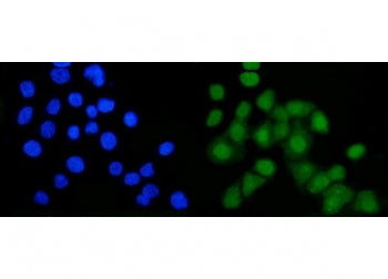 Immunofluorescent staining of FFPE human Caco-2 cells with B-Myb antibody (green) and DAPI nuclear s
