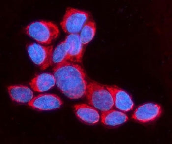 Immunofluorescent staining of FFPE human A549 cells with ANAPC1 antibody (red) and DAPI nuclear stai