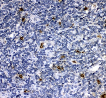IHC staining of FFPE human tonsil tissue with Cathepsin G antibody. HIER: boil tissue sections in pH8 EDTA for 20 min and allow to cool before testing.