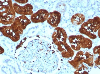 IHC staining of FFPE human kidney tissue with Fatty Acid Binding Protein 1 antibody (clone FABP1/852