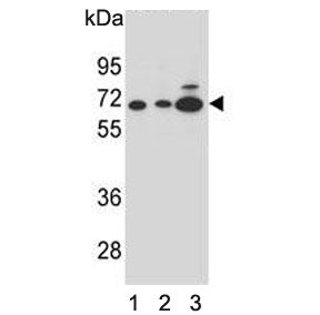 Western blot testing of human 1) HL60, 2) CEM and 3) K562 cell lysate with Alpha-amylase 2B antibody