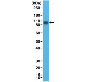 Western blot testing of human LNCaP cell lysate with recombinant CD276 antibody at 1:10,000 dilution