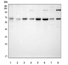 Western blot testing of 1) rat pancreas, 2) rat testis, 3) rat brain, 4) rat PC-12, 5) mouse pancrea