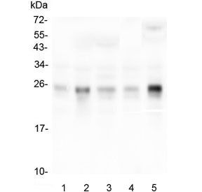 Western blot testing of human 1) placenta, 2) HepG2, 3) T-47D, 4) HeLa and 5) monkey COS-7 lysate wi