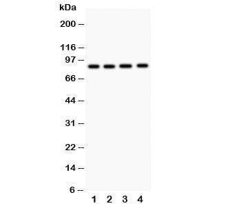 Western blot testing of NOX5 antibody and Lane 1: 22RV1; 2: PANC; 3: HeLa; 4: SKOV. Expected/observe