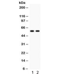 Western blot testing of 1) rat liver and 2) mouse liver lysate with CYP1A2 antibody. Predicted/obser