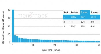 Analysis of a HuProt(TM) microarray containing more than 19,000 full-length human proteins using CEB