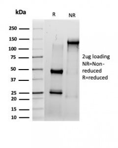 IRF3 Antibody