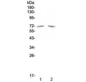 Western blot testing of human 1) MDA-MB-453 and 2) SW620 cell lysate with HDAC10 antibody at 0.5ug/m