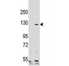 PARP Antibody