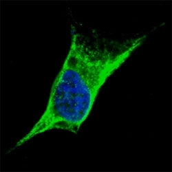 Vimentin Antibody