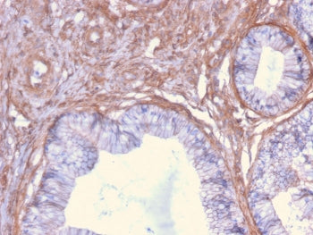 IHC staining of FFPE human cervix with Drebrin 1 antibody (clone DBN1/2879). HIER: boil tissue secti