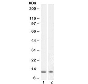 Western blot testing of human 1) olfactory bulb and 2) cerebellum lysate with S100 beta antibody at 