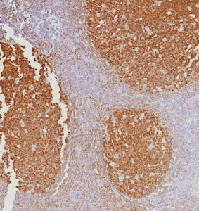 IHC staining of FFPE human tonsil tissue with BOB1 antibody (clone BOB1/7467). HIER: boil tissue sec