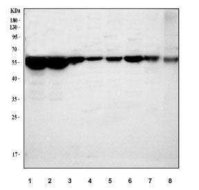 Western blot testing of 1) human A431, 2) human HepG2, 3) rat liver, 4) rat heart, 5) rat C6, 6) mou