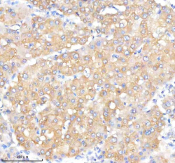 Immunohistochemical staining of IQGAP2 using anti-IQGAP2 antibody. IQGAP2 was detected in a paraffin