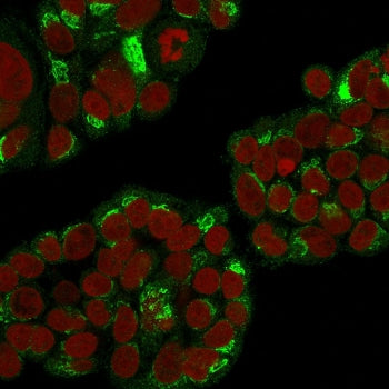 Immunofluorescent staining of permeabilized human MCF7 cells with EBAG9 antibody (green) and Reddot 