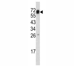 Western blot analysis of CD105 antibody and mouse heart tissue lysate. Observed molecular weight: 70