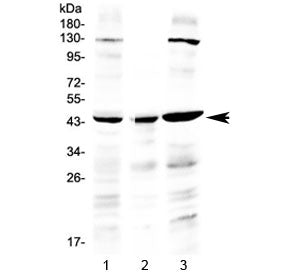 Western blot testing of human 1) HeLa, 2) placenta and 3) A549 lysate with PREB antibody at 0.5ug/ml