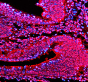 Immunofluorescent staining of PSMD1 using anti-PSMD1 antibody. PSMD1 was detected in a paraffin-embe