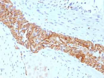 IHC staining of FFPE human colon tissue with CD56 antibody (clone rNCAM1/8655). HIER: boil tissue se