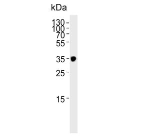 Western blot testing of human skeletal muscle lysate with IFNGR2 antibody. Expected molecular weight