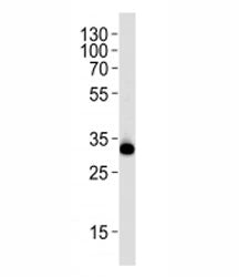 Western blot analysis of lysate from HeLa cell line using RPS6 antibody at 1:1000. Predicted molecul