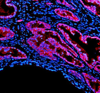 PDLIM5 Antibody / PDZ and LIM domain protein 5, 100ug