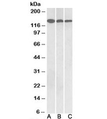 Western blot testing of human cerebellum [A], mouse brain [B] and rat brain [C] lysates with Contact