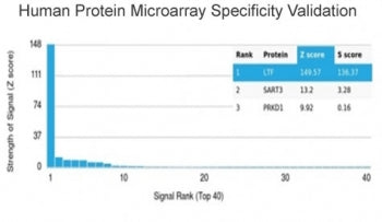 Analysis of HuProt(TM) microarray containing more than 19,000 full-length human proteins using LTF a