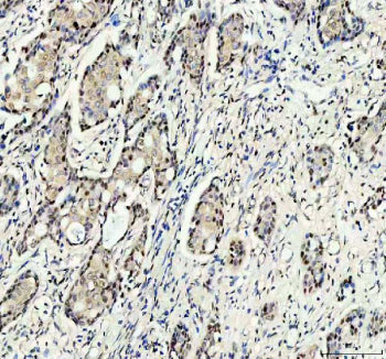 Immunohistochemical staining of RANBP3 using anti-RANBP3 antibody. RANBP3 was detected in a paraffin