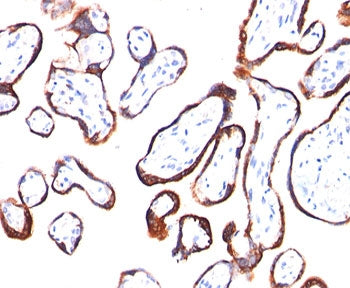 HCG-beta Antibody