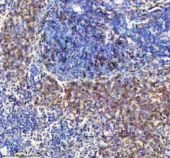 IHC staining of FFPE rat spleen tissue with CXCR5 antibody, HRP-secondary and DAB substrate. HIER: b