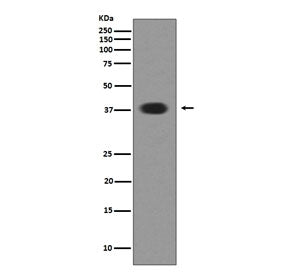 Western blot testing of human SH-SY5Y cell lysate with Musashi 1 antibody. Predicted molecular weigh