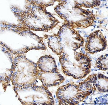 CA9 Antibody / Carbonic Anhydrase IX